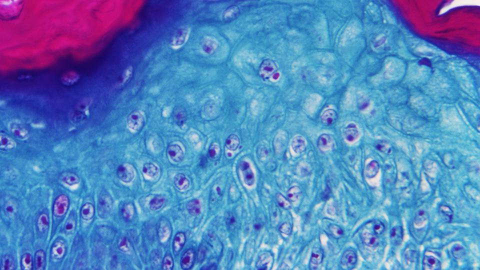 Under a microscope magnification of 500 x, a section of skin tissue, harvested from a lesion on the skin of a monkey, that had been infected with monkeypox virus, 1968. Courtesy of CDC.